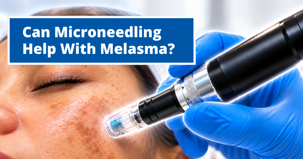 Banner Melasma